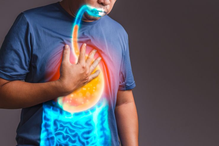 Gastroesophageal Reflux Disease